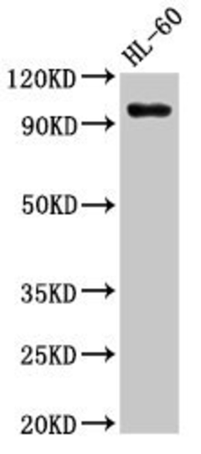 100UG SUV420H1 ANTIBODY 100 ug