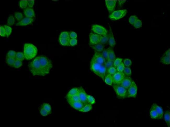 100UG VPS26B ANTIBODY 100 ug