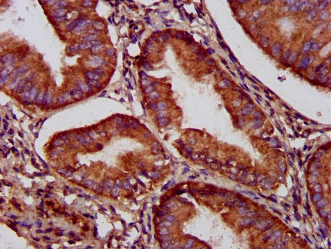 100UG C5ORF33 ANTIBODY 100 ug