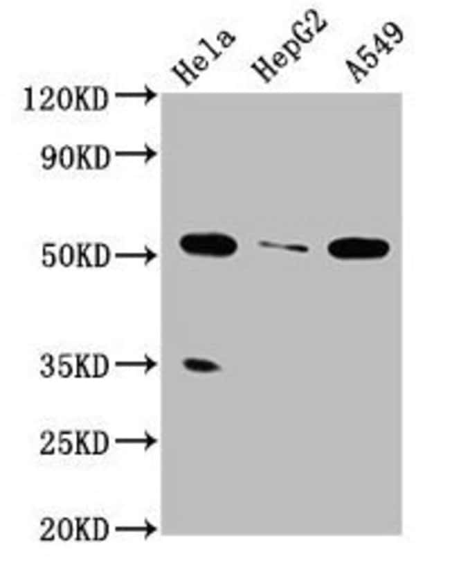100UG ZMYND17 ANTIBODY 100 ug