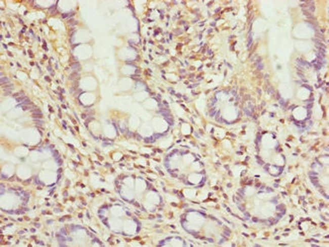 100UG MRPL51 ANTIBODY 100 ug