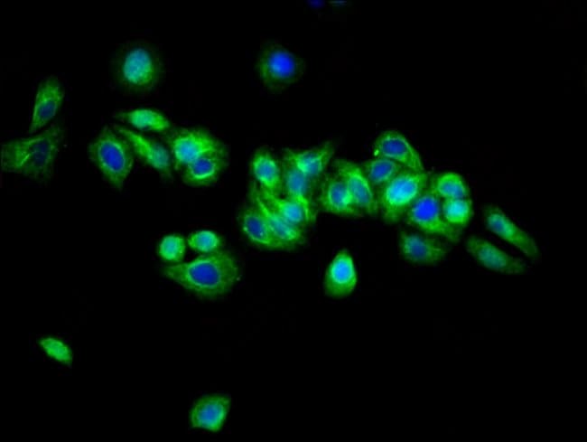 100UG ARSH ANTIBODY 100 ug