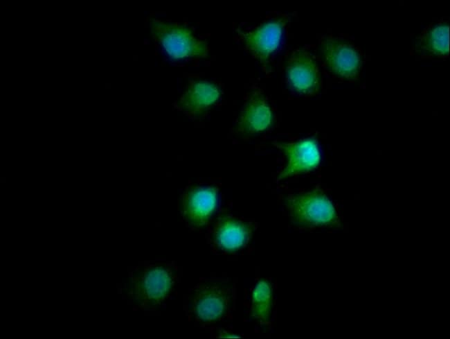 100UG FMN1 ANTIBODY 100 ug