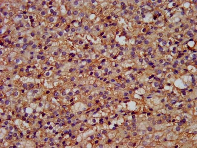 100UG GPR177 ANTIBODY 100 ug
