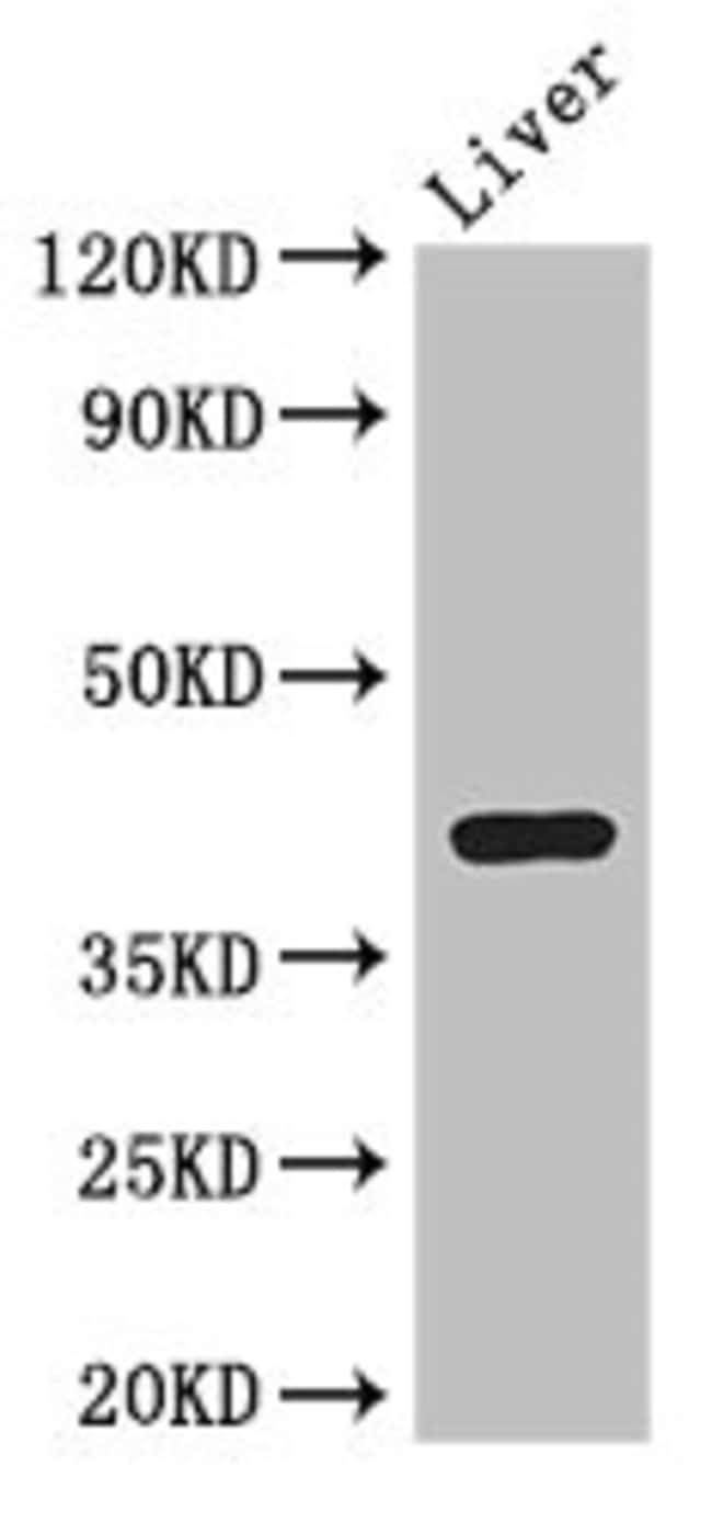 100UG ADH7 ANTIBODY 100 ug