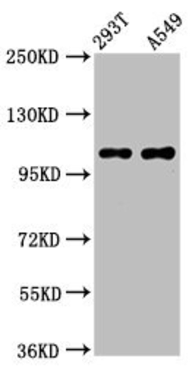 100UG NARG2 ANTIBODY 100 ug