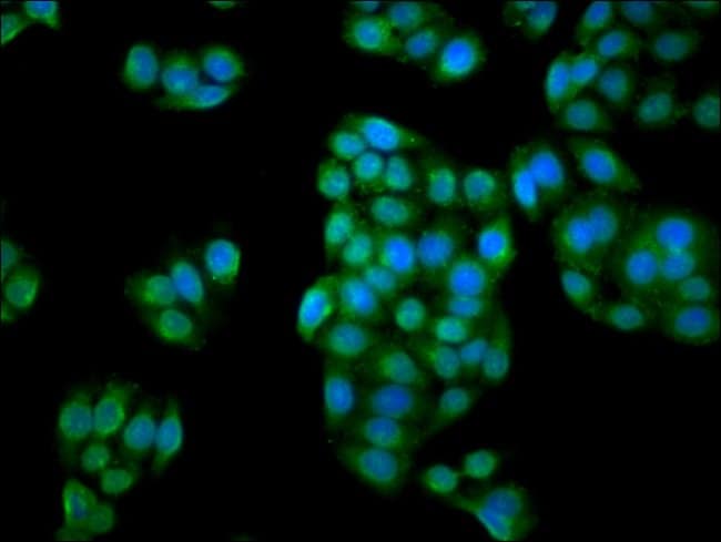 100UG C1ORF69 ANTIBODY 100 ug