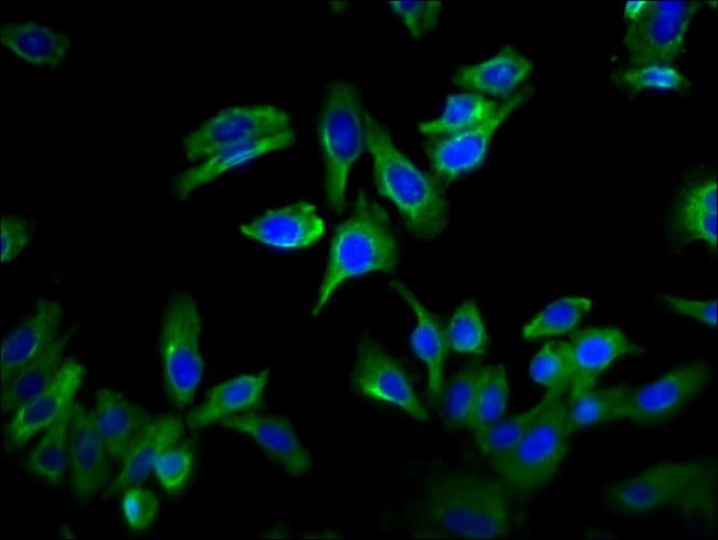 100UG GPRC6A ANTIBODY 100 ug