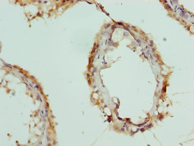 100UL CPSF3L ANTIBODY 100 ul
