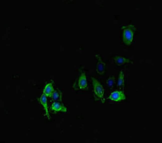 100UG PPP2R2D ANTIBODY 100 ug