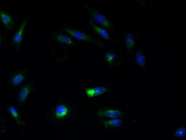100UG ATL3 ANTIBODY 100 ug