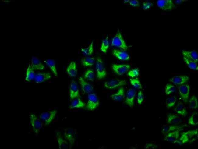 100UG C1ORF58 ANTIBODY 100 ug