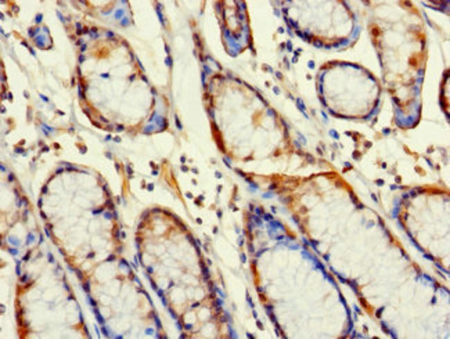 100UG RBG1L ANTIBODY 100 ug