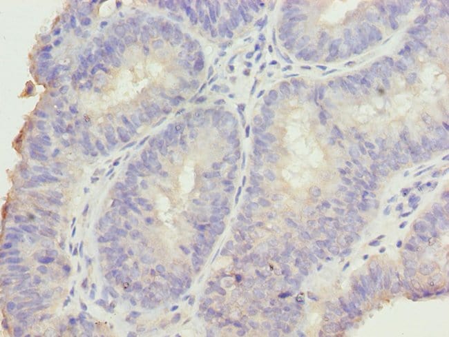 100UG DDI2 ANTIBODY 100 ug