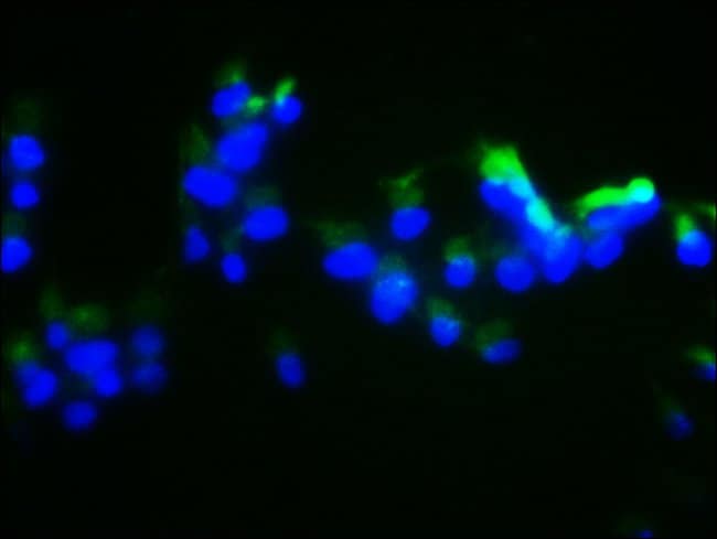 100UG DUSP13 ANTIBODY 100 ug