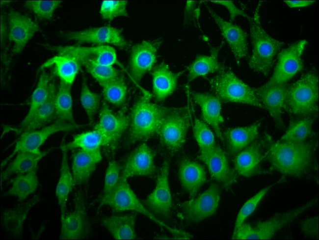 100UG ICB-1 ANTIBODY 100 ug