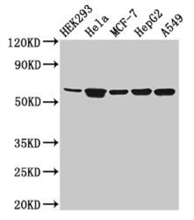 100UG CYP4F22 ANTIBODY 100 ug
