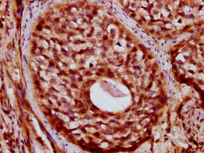 100UG ZC3H14 ANTIBODY 100 ug
