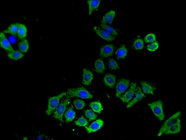 100UG SLC16A9 ANTIBODY 100 ug