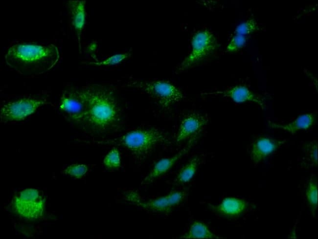 100UG SLC25A24 ANTIBODY 100 ug