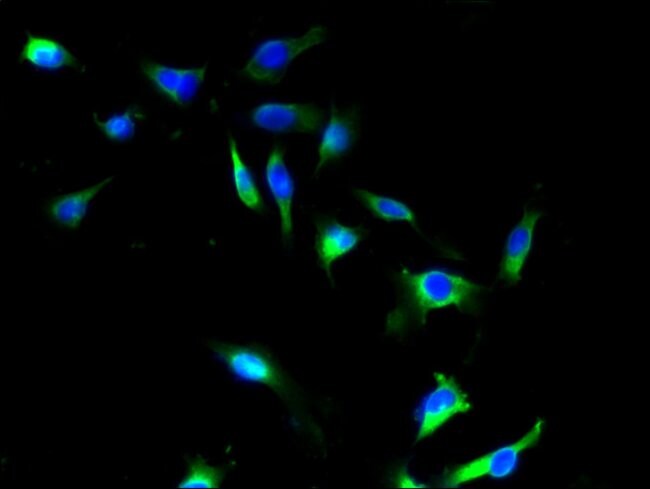 100UG SFXN4 ANTIBODY 100 ug