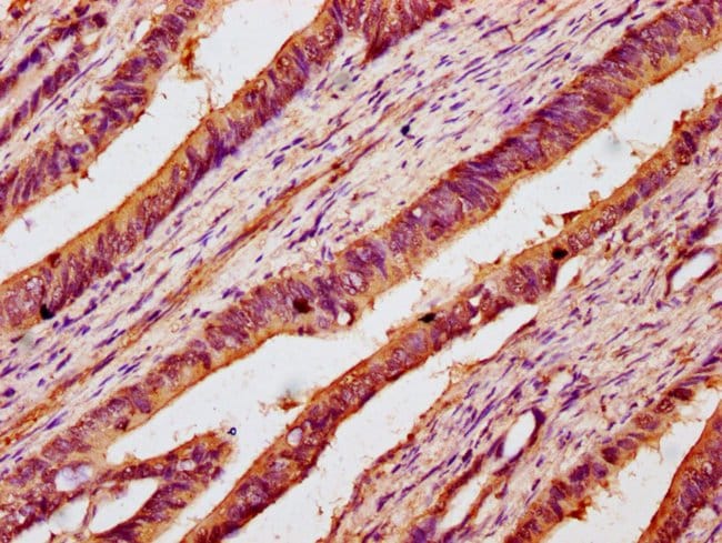 100UG B3GNT6 ANTIBODY 100 ug