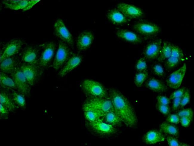 100UG PCID1 ANTIBODY 100 ug