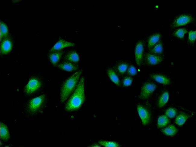 100UG TCTN3 ANTIBODY 100 ug