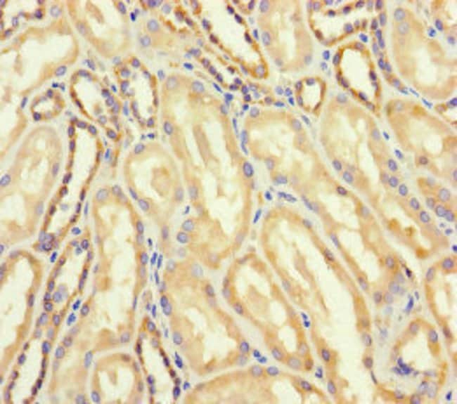 100UG ASPRS ANTIBODY 100 ug