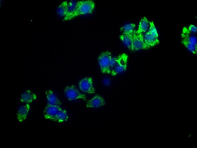 100UL ENPP7 ANTIBODY 100 ul
