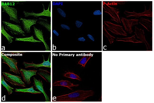 100UG RAB12 ANTIBODY 100 ug