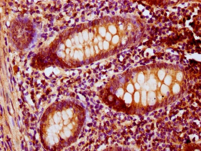 100UG PNCK ANTIBODY 100 ug