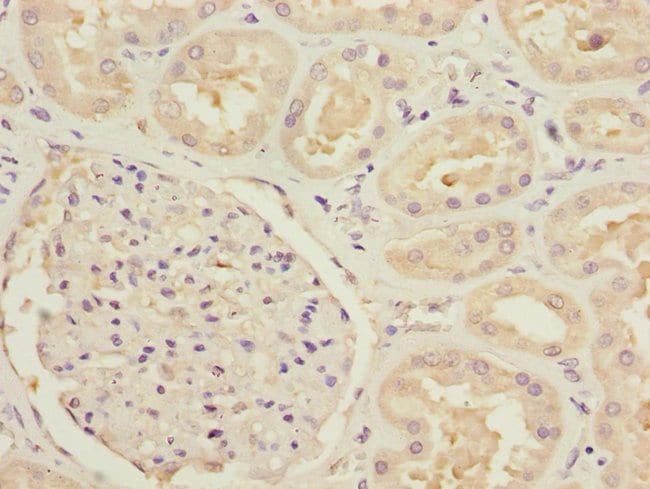 100UL MTHFD1L ANTIBODY 100 ul