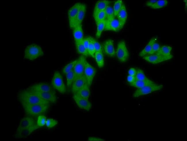 100UG DPY19L3 ANTIBODY 100 ug