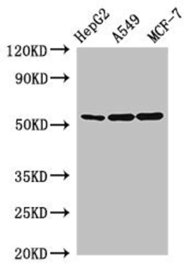 100UG SLC24A5 ANTIBODY 100 ug