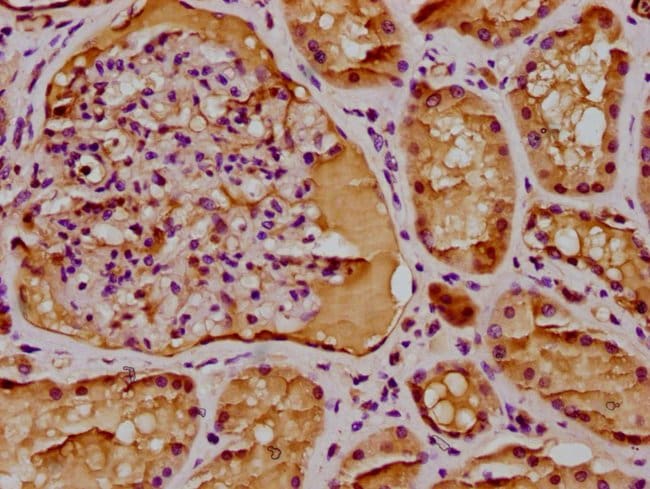 100UL BAAT1 ANTIBODY 100 ul