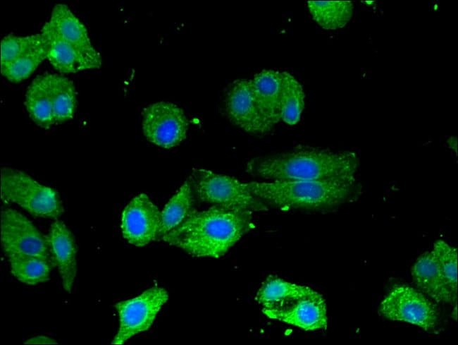 100UG TORC1 ANTIBODY 100 ug