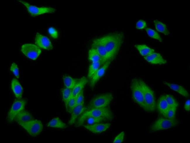 100UG SLC16A12 ANTIBODY 100 ug