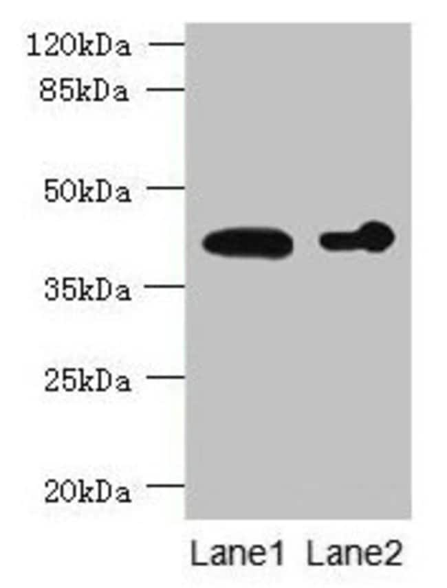 100UG ASPHD2 ANTIBODY 100 ug