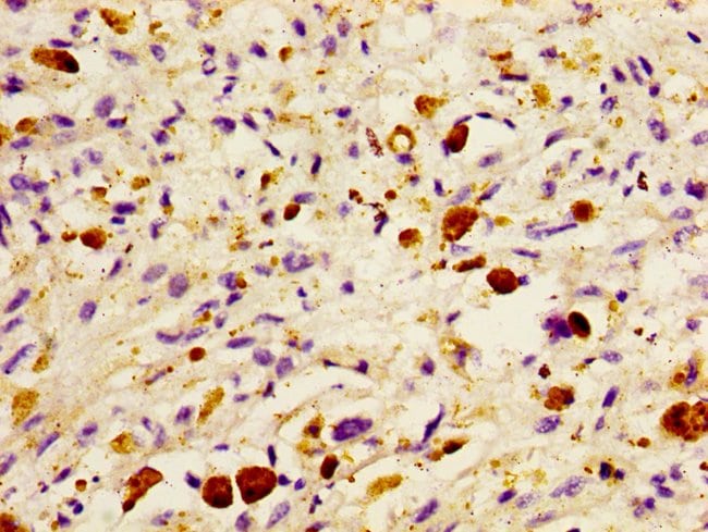 100UG DHRS13 ANTIBODY 100 ug