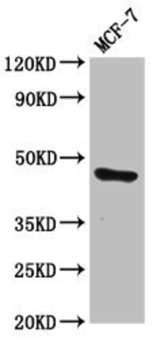 100UG TFAP2E ANTIBODY 100 ug