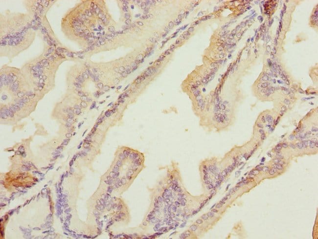 100UG HSDL2 ANTIBODY 100 ug