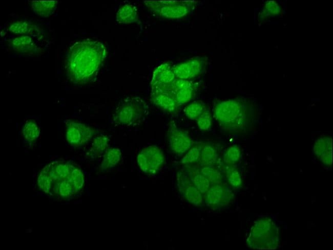 100UG MACC1 ANTIBODY 100 ug