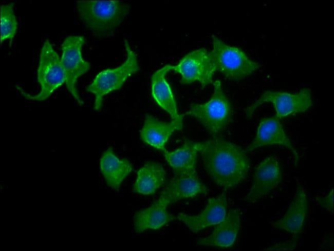 100UG TTI2 ANTIBODY 100 ug