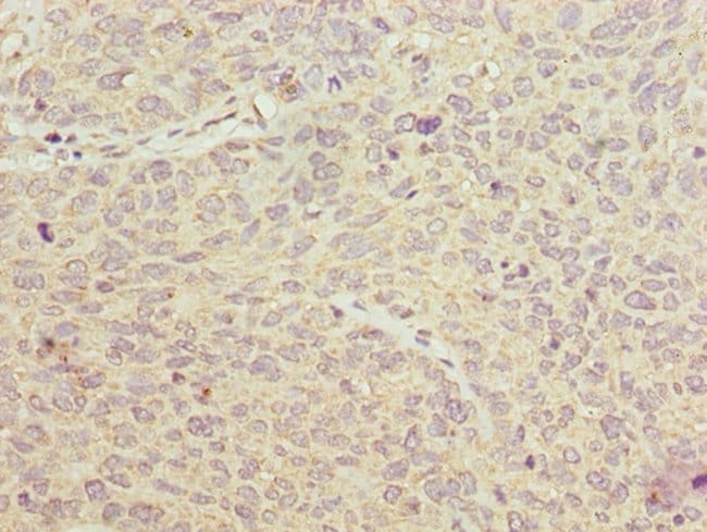 100UG PGM2L1 ANTIBODY 100 ug
