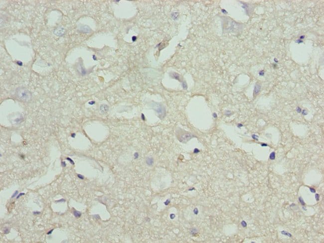 100UG STOX1 ANTIBODY 100 ug