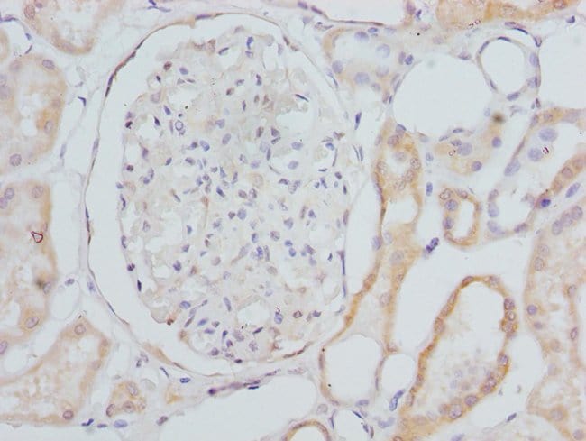 100UL CYP4V2 ANTIBODY 100 ul