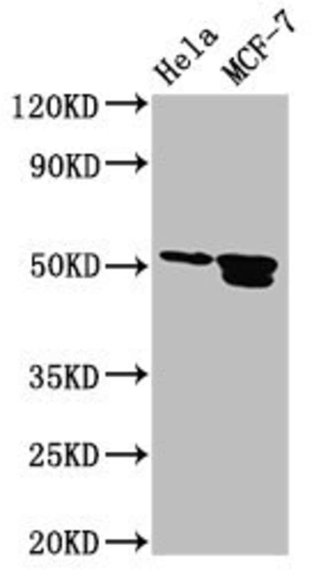 100UG AP2 BETA ANTIBODY 100 ug