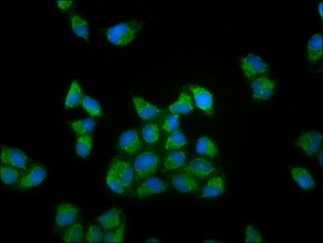 100UG RIPX ANTIBODY 100 ug