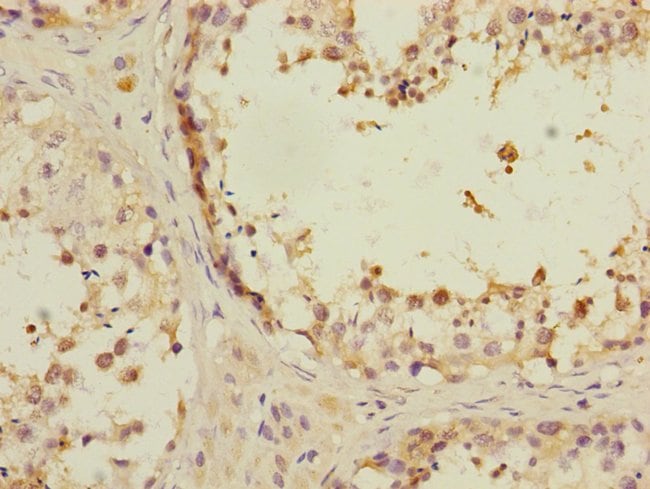 100UL ANKS1B ANTIBODY 100 ul